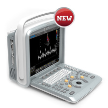 Ultrasound Scanner Color Doppler Laptop Portable (SC-Q9)